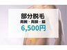 【メンズ脱毛】【両腕・両脇・両脚】見える部位3箇所セット脱毛 ¥6,500