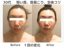 マテリアル(MATERIAL)/短くなってしまっていた首