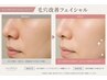 【毛穴レス美肌へ】本気の肌質改善ダーマコース ￥11000