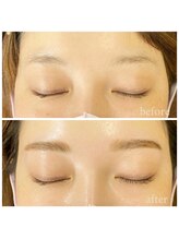 エムアンド(m&)/ブロウリフト＆ワックス脱毛