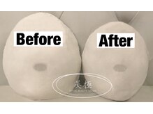 美極 銀座店/銀座/小顔コルギ/小顔矯正