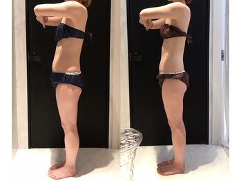 リボディ 表参道(An re Body)/before→after