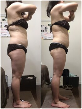 ビューティーワークス シャンティ 新鎌ヶ谷店(Beauty Works Shanti)/お客様の成果☆3枚目