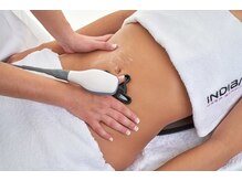 エスペランサプレミアム新宿店/インディバ施術の様子