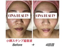 ジナ ビューティ(GINA BEAUTY)/