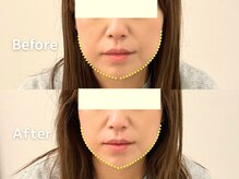 蓮子堂鍼灸整体院/気になるたるみお任せください♪