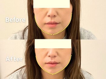 蓮子堂鍼灸整体院/気になるたるみお任せください♪