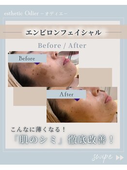 オディエ(Odier)/エンビロントリートメントシミ