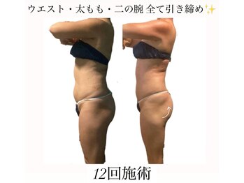 痩身革命 大宮店/ダイエットリンパマッサージ