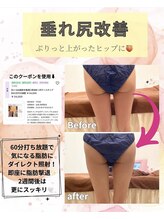 ウナ デ リンゴル 恵比寿店(UNA de Ringol)/