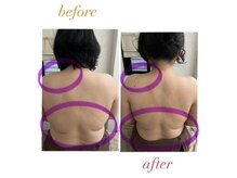 1回でこの変化！背中スッキリ美姿勢へ！津市/リンパ/肩こり