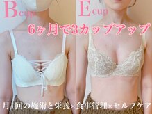 ベリンダ(belinda)の雰囲気（バストアップ/産後の下垂/左右差などの悩みに合わせたバストケア）