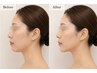 【小顔と首肩スッキリ！】本格骨格美小顔フェイシャル（足指圧付）60分