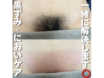 カナウ(KANAU)の写真/【ワックス脱毛と光脱毛が5,500円】不快な蒸れ・ニオイを解決◎生理中のお手入れもラクになる