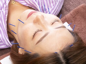 クシロ鍼灸整骨院/【美容鍼】鍼に電気は使いません