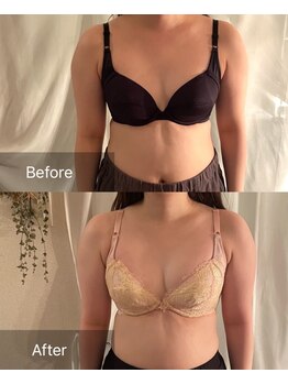 ハートランド(HEARTLAND)/お試しバスト2回の変化