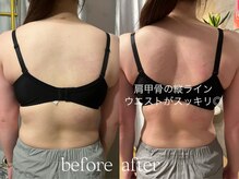 ビウラ(BIURA)/【20代】1回目の施術