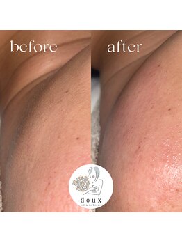 ドゥ(doux)/フェイスワックス