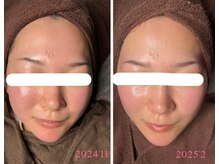 マリーメリー(marie merry)/水玉リフティング