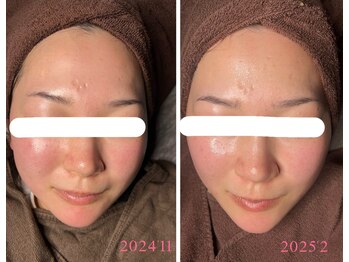 マリーメリー(marie merry)/水玉リフティング