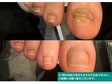 地爪ケアクリニックサロン 代々木店/爪、あきらめていませんか？