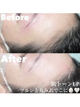 ドール アイラッシュ(D'or EYELASH)/韓国ヘアラインWax