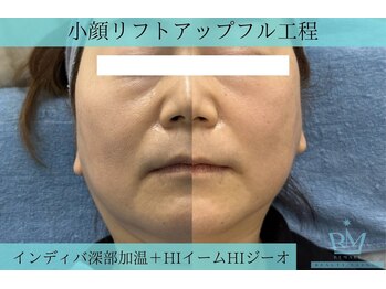 リメイク 広尾(REMAKE)/