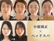 まどろみ(madoromi)の雰囲気（リピート人気【小顔矯正】加齢による顔変化お悩みの方へおすすめ）