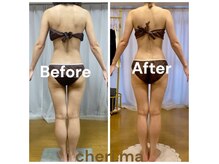 置きっぱなし脂肪を全身徹底ケア見た目を変えたい方に◎