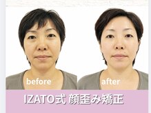 小顔矯正 イザト整体院(IZATO)/顔歪み矯正before＆after