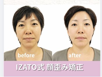 小顔矯正 イザト整体院(IZATO)/顔歪み矯正before&after