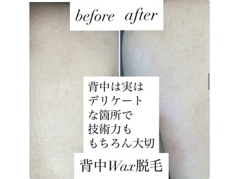 リアンジェ(Lianje)/背中はデリケート