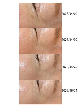 ミガキヤ(MIGAKIYA)の写真/光フォトで綺麗な肌を叶えるケアで、ハリ・弾力アップを目指す贅沢な時間♪