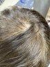 【スカルプケア】今話題!!<ヒト幹細胞導入>で髪質改善☆育毛促進たるみケア
