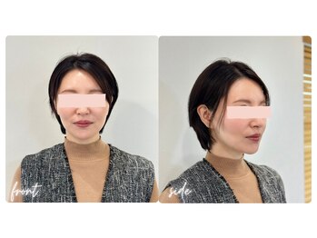 スタイルキューピット(style cupit)/メイクビフォアフター*30代