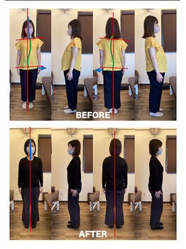 やまな整骨院/姿勢の矯正