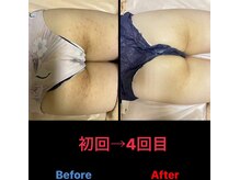 美尻研究所 福岡大名店/