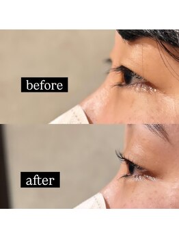 ウェヌス アイ ビューティ(VENUS eye beauty)/ラッシュリフト