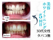 ルカノン(le canon)/笑顔も心も明るくなりました(^^)