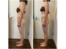 アクアガーデン(Aqua Garden)の雰囲気（ハイパーナイフ全身☆アフターケア付き！）