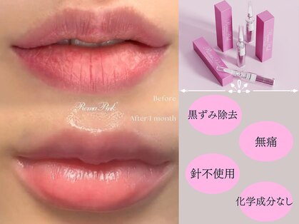 アンジェロ(Angelo)の写真