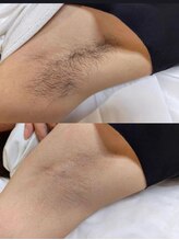 ファースト(1st)/