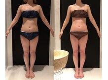 リボディ 表参道(An re Body)/before→after