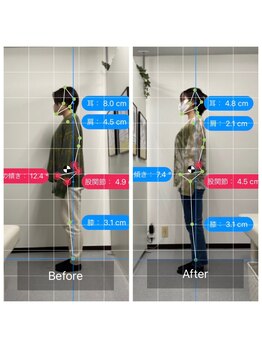 ナオル整体 池袋院(NAORU整体)/姿勢の変化♪【池袋 整体】