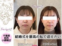 フェイシー(faceyee)/