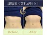 【最新マシーンで成功するダイエット】お腹を美クビレに引き締めコース￥9,350