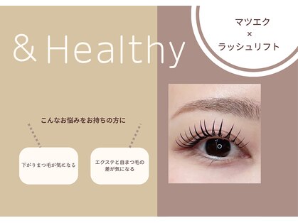 エヌアイズ(neYES!)の写真