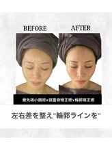 ルシエル/美容関係者にも選ばれる小顔術