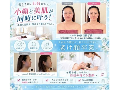 フローラの写真