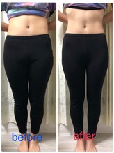 激痛ダイエット整体 八巻/お腹周り！/ダイエット/くびれ